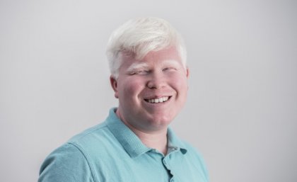 Man with albinism smiling into camera 